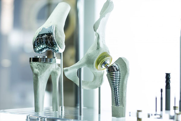 Joint replacements and surgical replacements